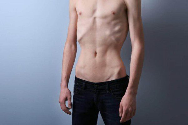 Emaciated Bodies, Visually Disturbing, Barechested Male, Suggestive
