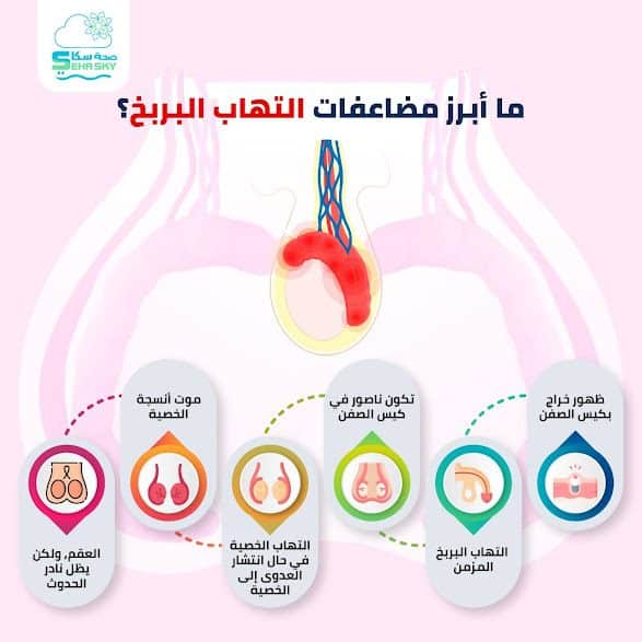 انفوجرافيك: ما أبرز مضاعفات التهاب البربخ؟ 2 IMG 20220506 WA0003 1