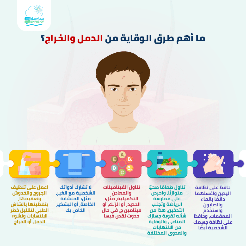 انفوجرافيك: ما أهم طرق الوقاية من الدمل والخراج؟ 3 ما أهم طرق الوقاية من الدمل والخراج؟ 0١