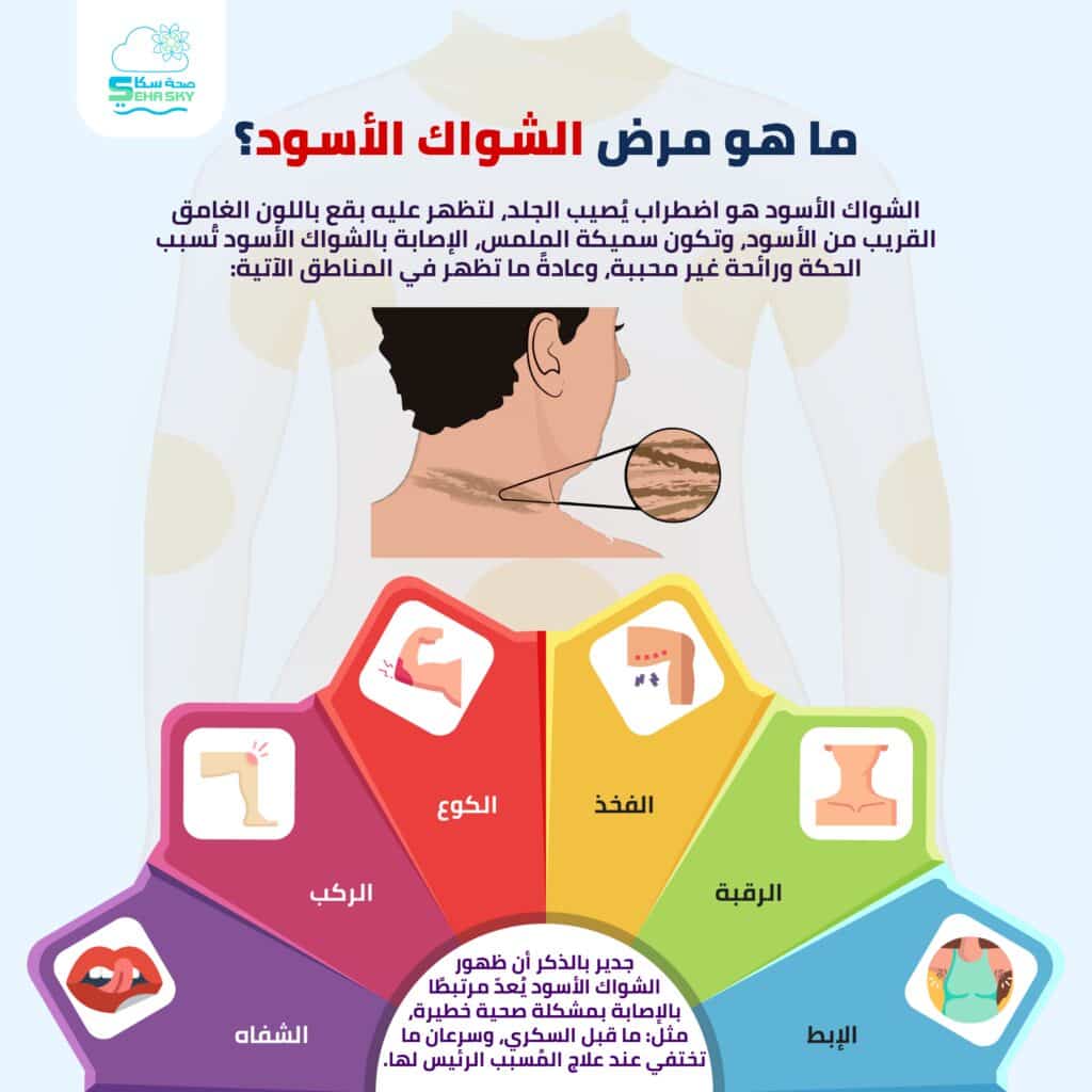 انفوجرافيك: ما هو مرض الشواك الأسود؟ 2 ما هو مرض الشواك الأسود؟ 01