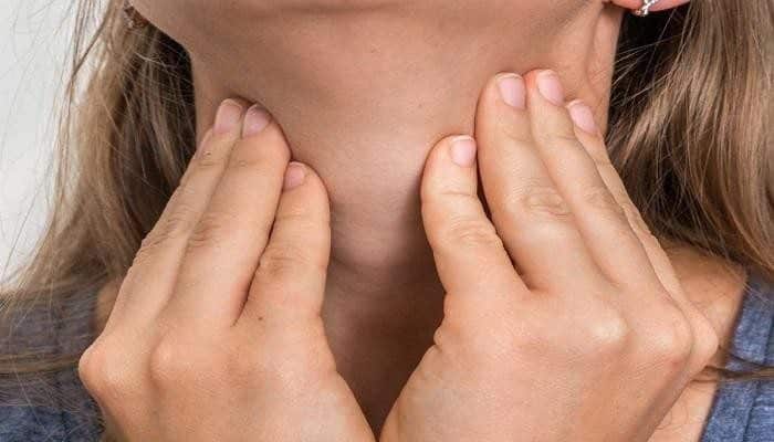 فرط نشاط الغدة الدرقية 4