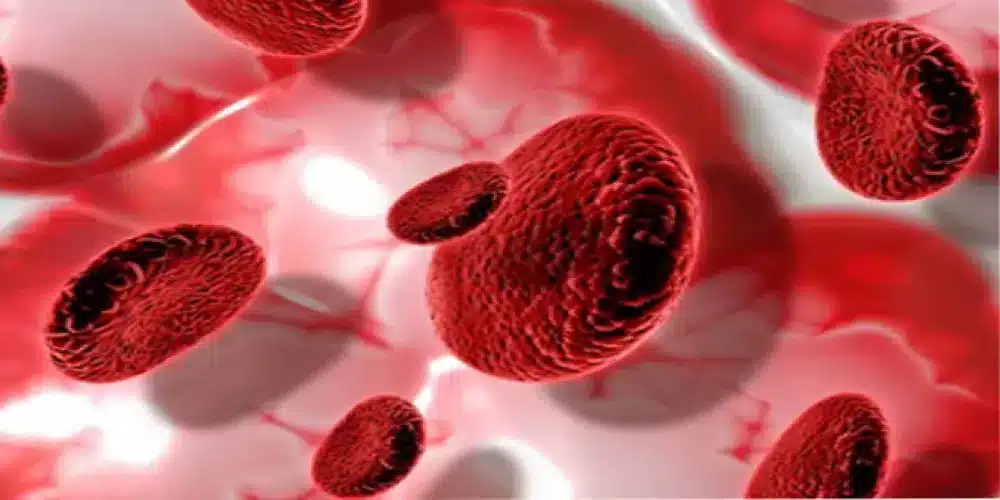 ما علاج ابيضاض الدم النخاعي المزمن؟ 1 webp