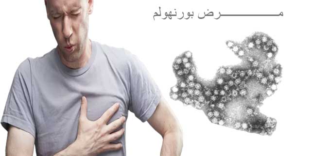 مرض بورنهولم
