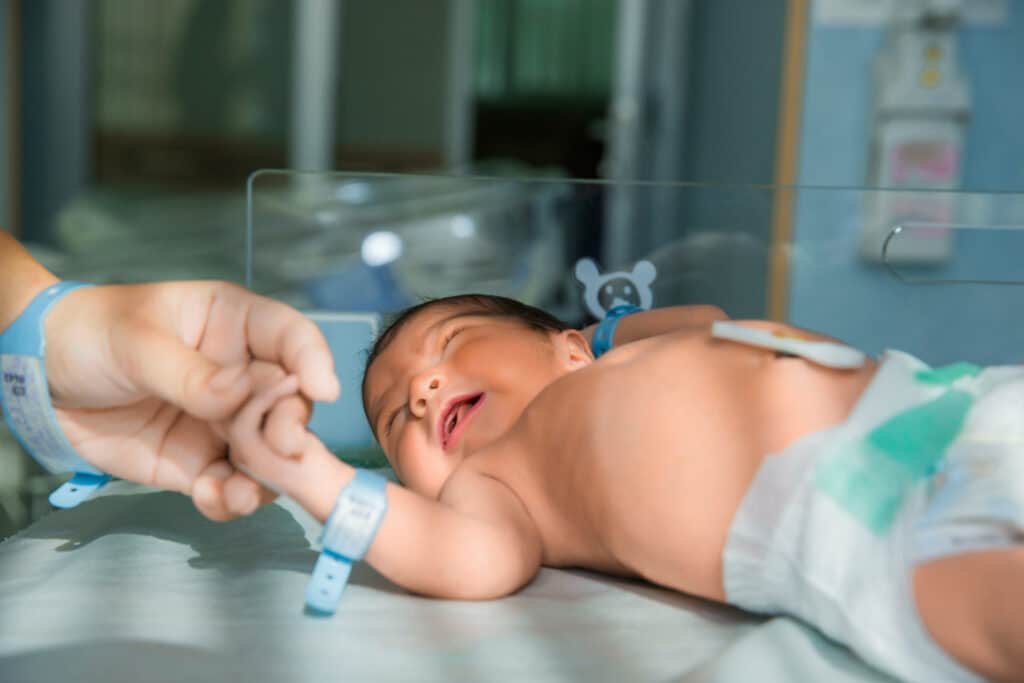 طفل يعاني من متلازمة الضائقة التنفسية عند حديثي الولادة