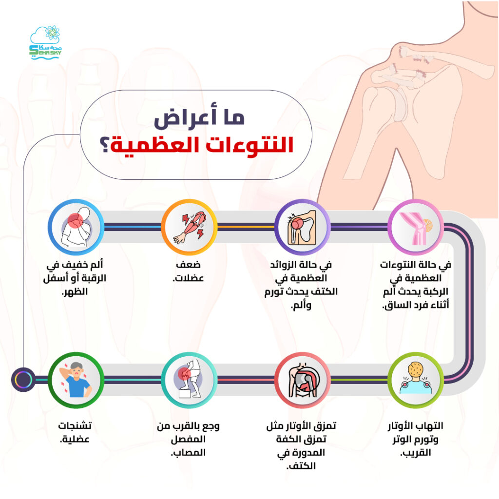 انفوجرافيك: ما أعراض النتوءات العظمية؟ || 2026 || صحةسكاي