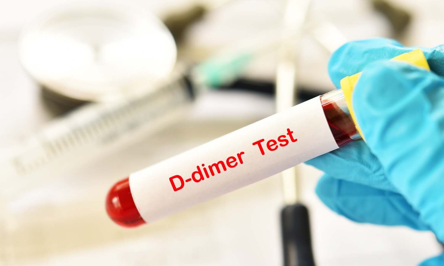 ما الفرق بين تحليل INR وD. Dimer؟ 2024 صحةسكاي