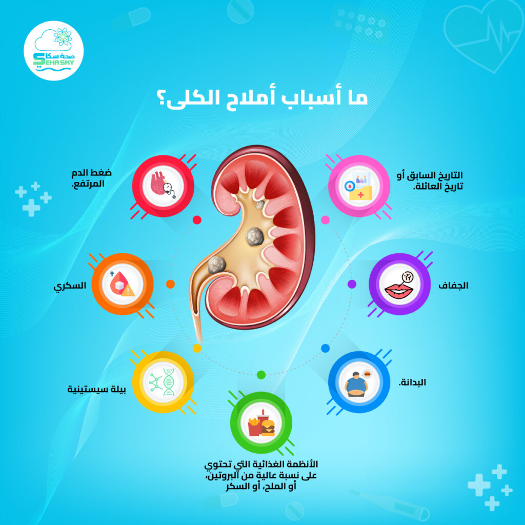 انفوجرافيك: ما أسباب أملاح الكلى؟ || 2026 || صحةسكاي